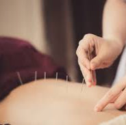 Espace Santé: Acupuncture et Tuina